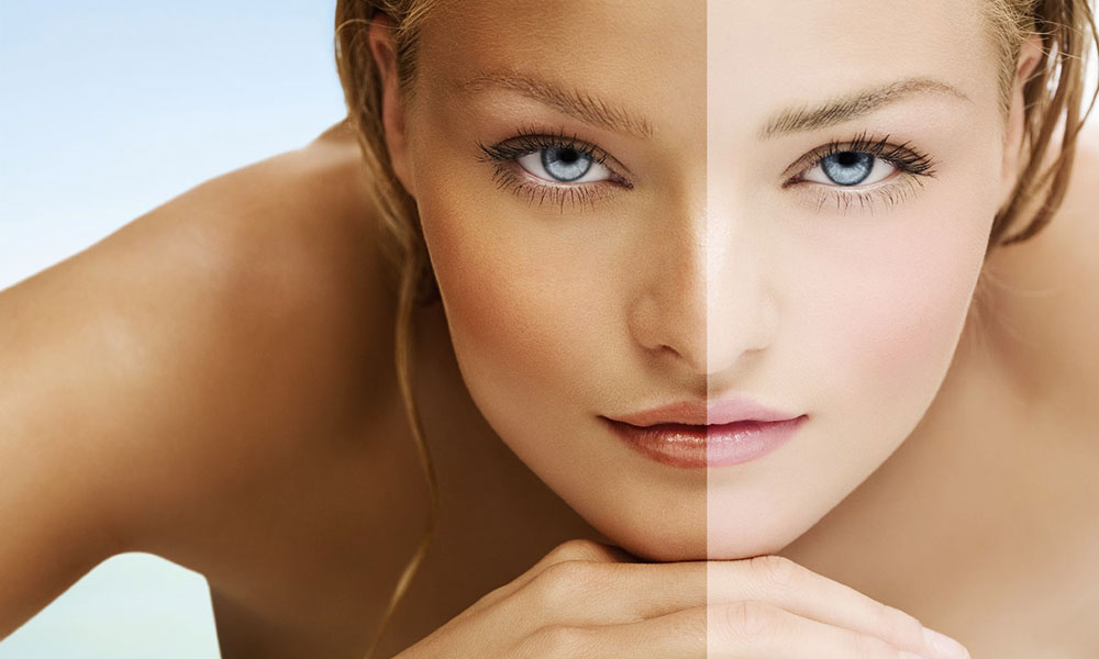 Home Remedies For Fair Skin Are Better Than Fairness Cream