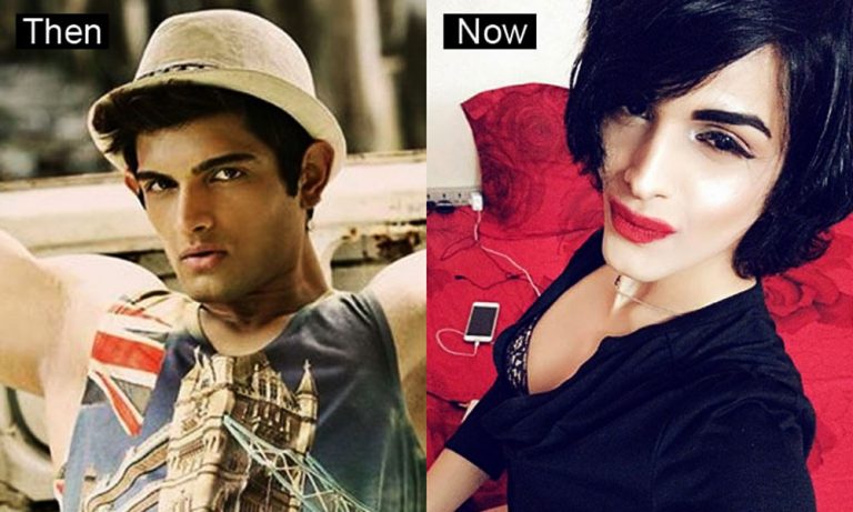 Gaurav Arora - His Shocking Transformation Will Definitely Surprise You