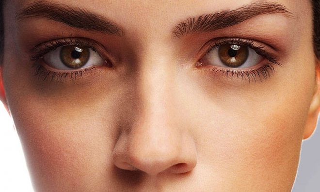 Causes Of Dark Circles